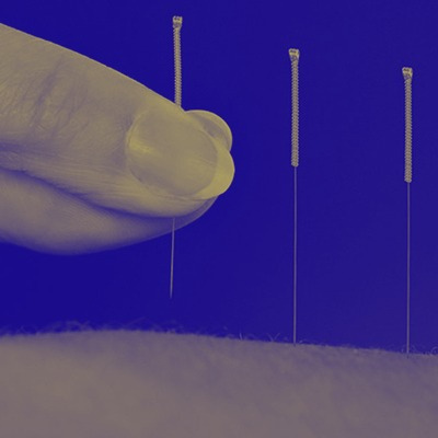 Acupuncture at WHA